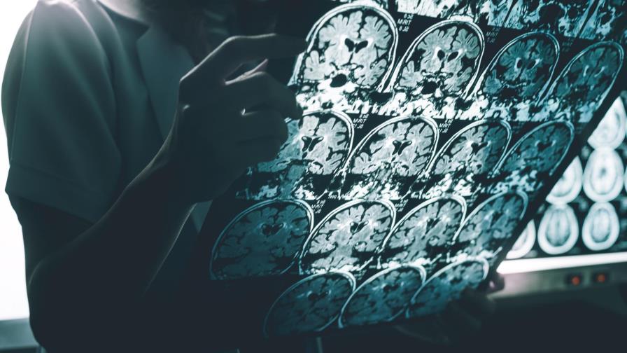 Desarrollan un nuevo modelo biológico para tratar el Alzheimer Desarrollan un nuevo modelo biológico para tratar el Alzheimer