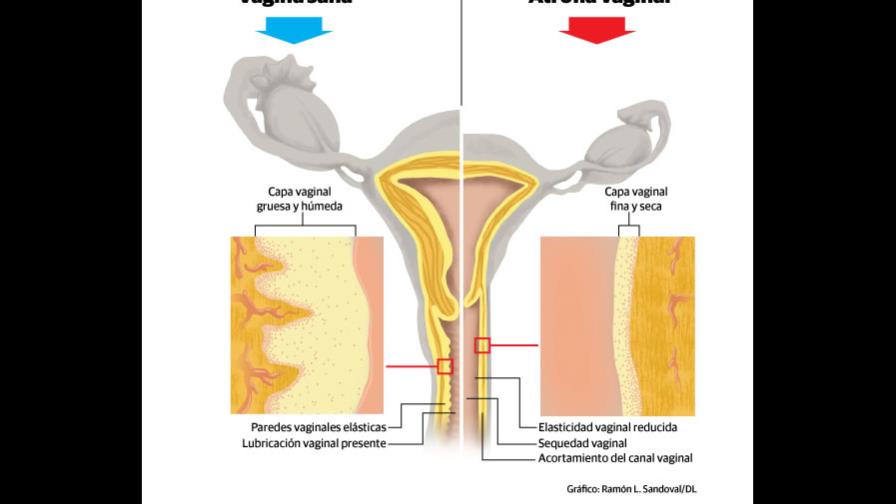 Nueva técnica para realzar la belleza y la vida sexual femenina