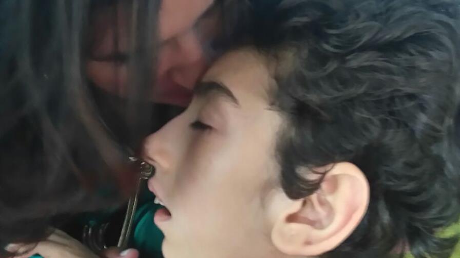 Parálisis cerebral es la discapacidad  más frecuente durante la infancia