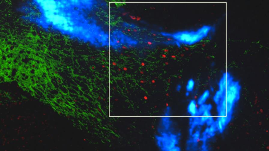 Hallan un método “menos invasivo” para estimular el cerebro mediante luz