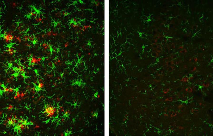 Revierten en ratones la formación de placas amiloide que causan el Alzhéimer