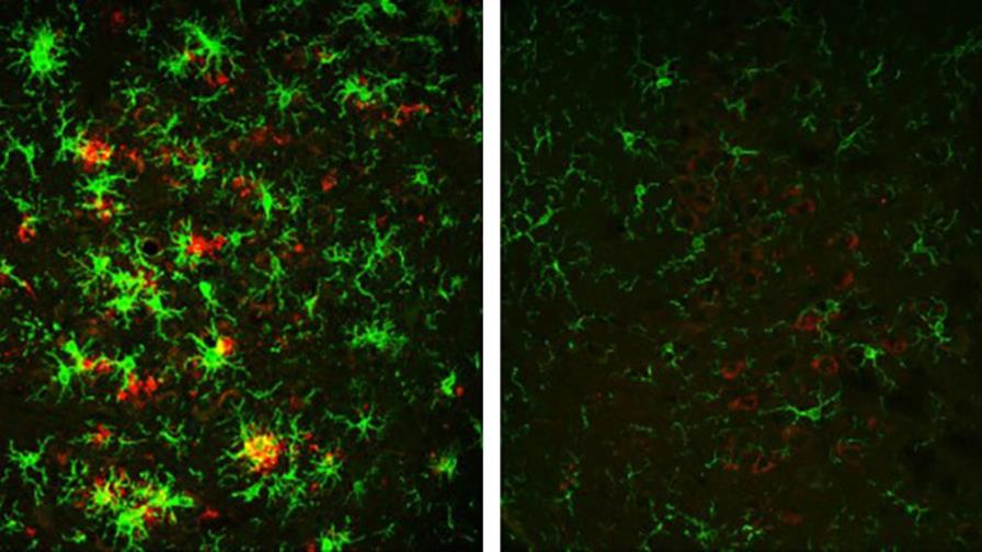 Revierten en ratones la formación de placas amiloide que causan el Alzhéimer Revierten en ratones la formación de placas amiloide que causan el Alzhéimer
