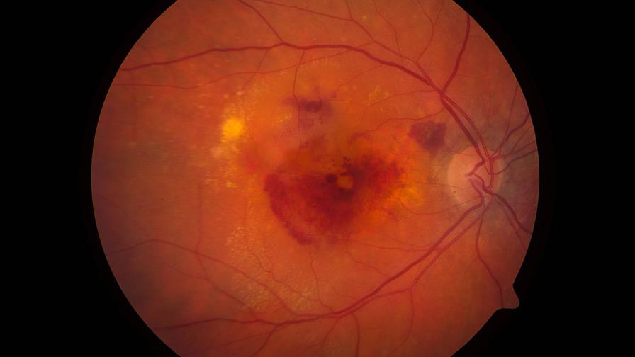 Usan inteligencia artificial para detectar enfermedades oculares y neumonía