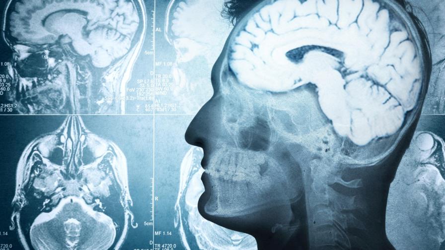 Científicos ven por primera vez todas las células de una región cerebral 