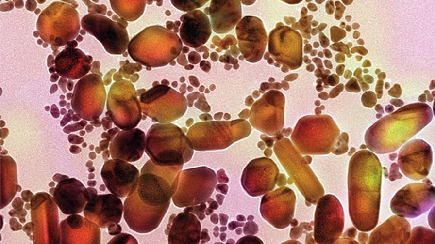 Nanopartículas de oro ayudan a buscar fibras amiloides, ligadas al párkinson