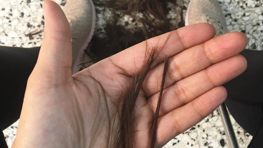 Juliana se afeita la cabeza tras caída del cabello por quimioterapia 