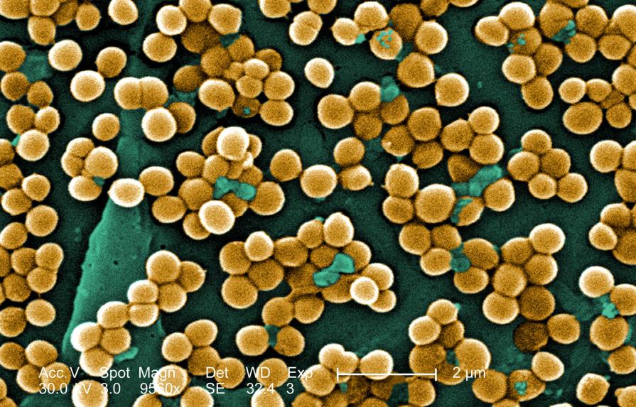 Identifican la base molecular de las bacterias resistentes a antibióticos