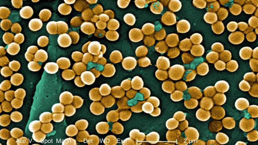 Identifican la base molecular de las bacterias resistentes a antibióticos