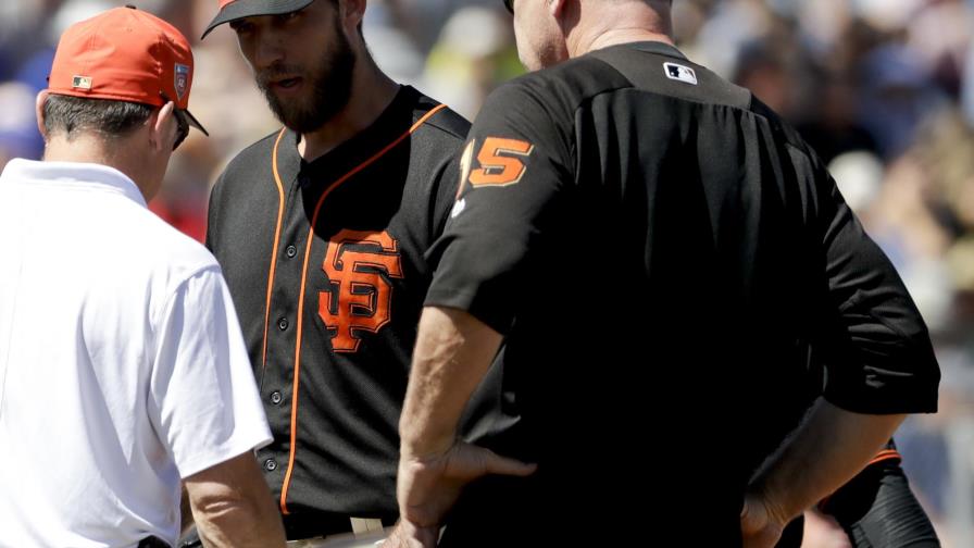 Pelotazo le fractura la mano de lanzar a Bumgarner Pelotazo le fractura la mano de lanzar a Bumgarner