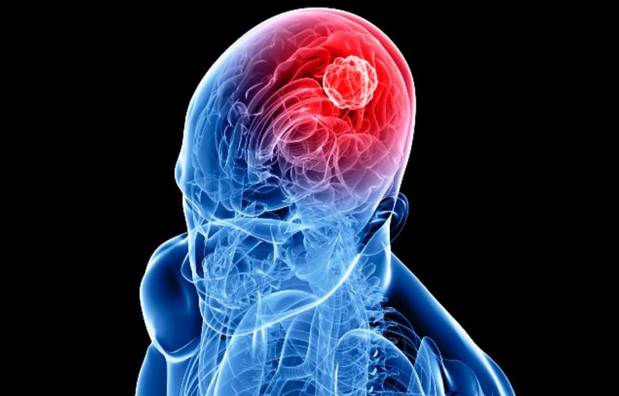 Una biopsia de líquido cefalorraquídeo permite diagnosticar tumor cerebral 