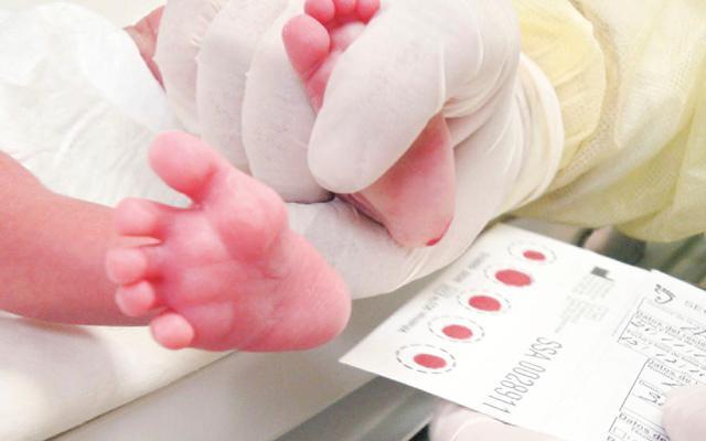 Prueba de tamizaje neonatal es necesaria para diagnosticar pacientes con fibrosis quística