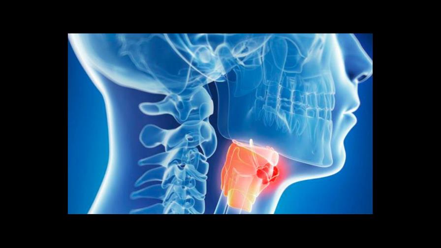 Cada año se diagnostican en México 3,000 tumores de cabeza y cuello