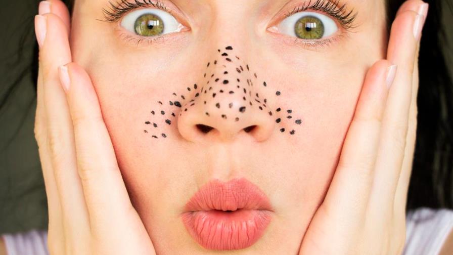 Estas mascarillas te ayudarán a eliminar los puntos negros Estas mascarillas te ayudarán a eliminar los puntos negros