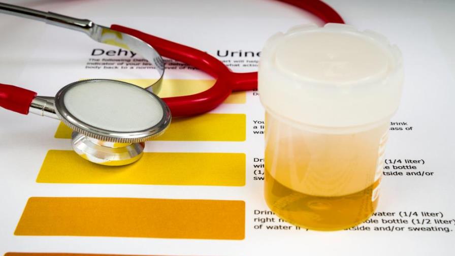 ¿A qué se debe el color y el olor de la orina? ¿A qué se debe el color y el olor de la orina?