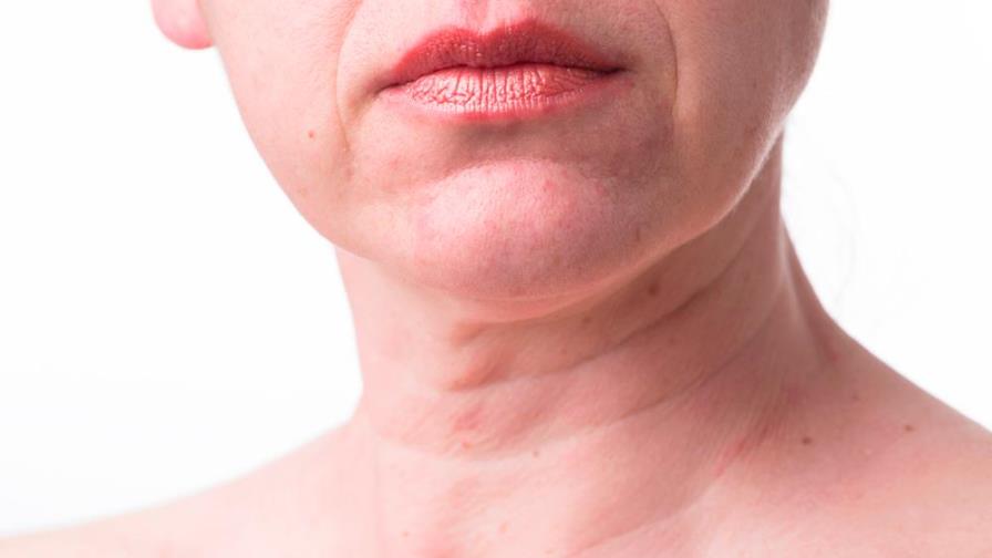 Cinco remedios naturales para lucir un escote y cuello sin arrugas Cinco remedios naturales para lucir un escote y cuello sin arrugas