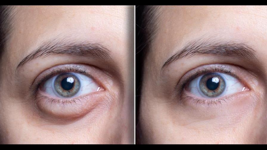 La piel también se estresa: algunas señales