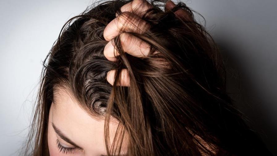 Consejos para controlar tu pelo graso