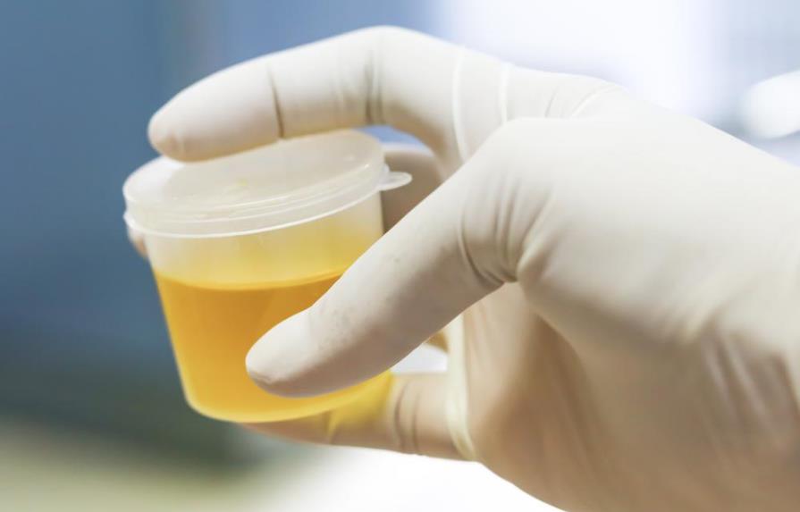 Se podrá detectar el cáncer de útero con un sencillo test de orina