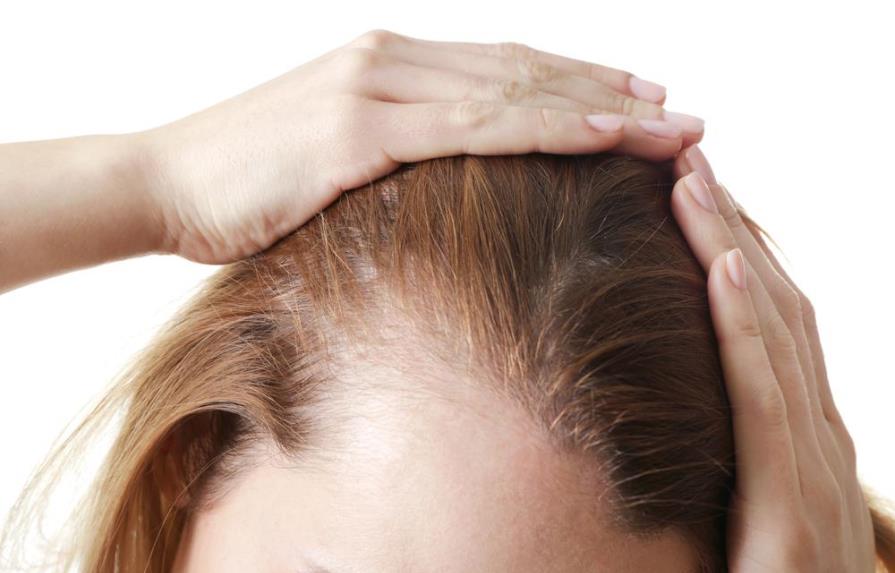 Motivos y detalles que delatan alopecia femenina