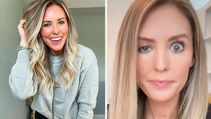 Video | “Influencer” y su fallida experiencia con botox que le ha dejado “mirada de loca”