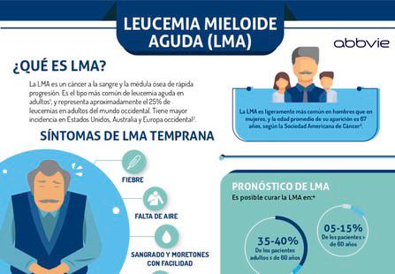 Infografía