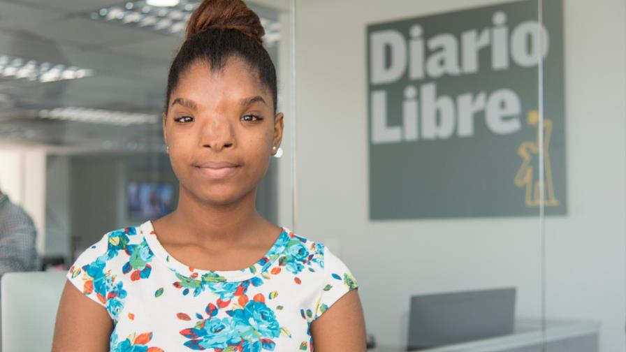 Puello Herrera muestra interés por caso estudiante con hipertelorismo