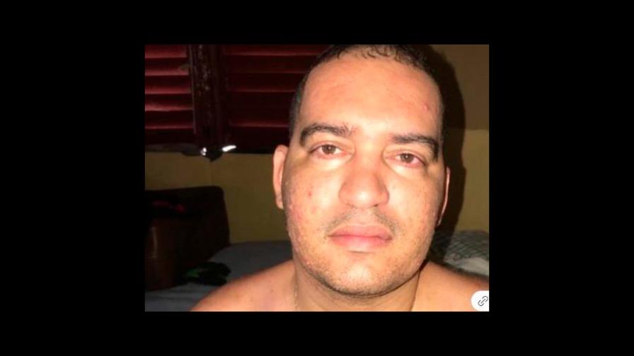 Joven solicita ayuda económica para remover tumor cerebral Joven solicita ayuda económica para remover tumor cerebral