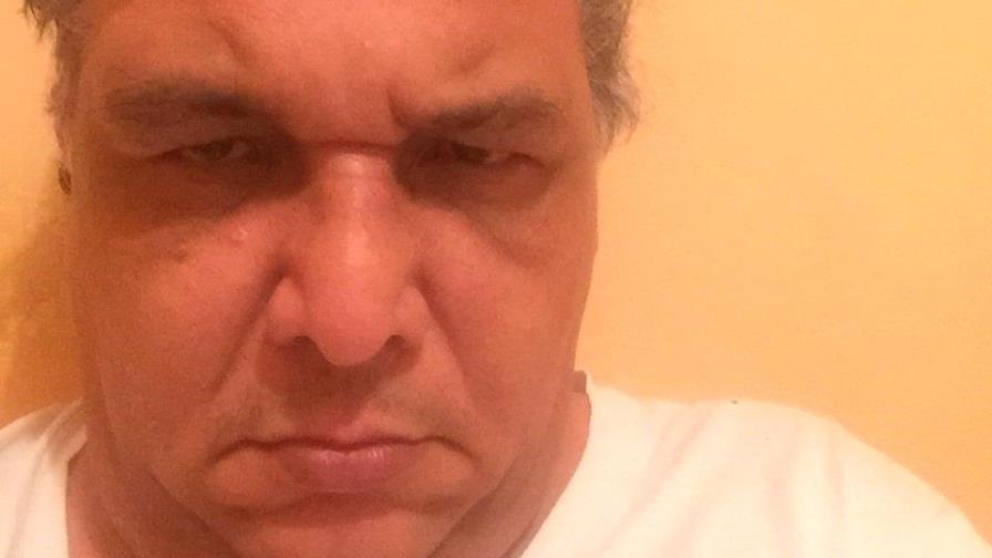 Artista visual herido en protesta por resultados electorales en el Codap