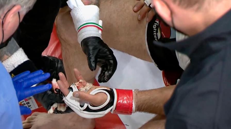 Peleador de artes marciales mixtas pierde dedo en combate