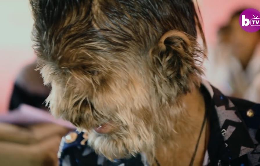 Hombre lobo real: niño de 13 años sufre una condición rara que cubre su rostro de cabello