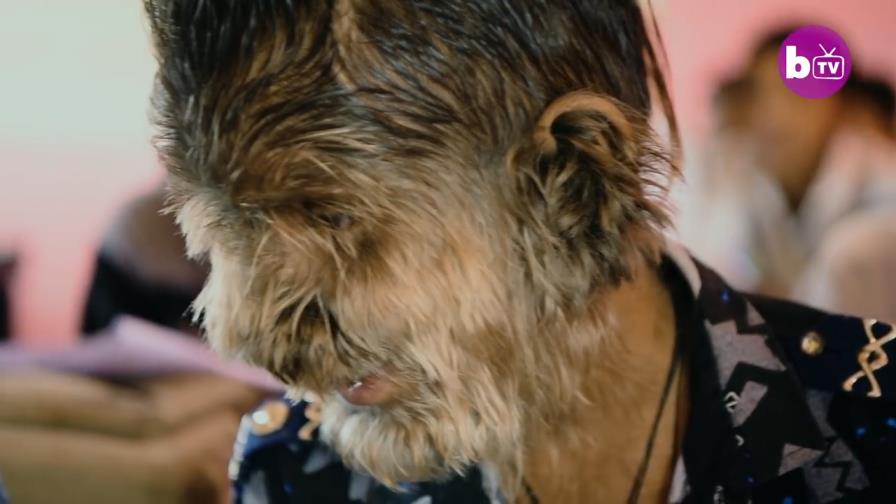 Hombre lobo real: niño de 13 años sufre una condición rara que cubre su rostro de cabello