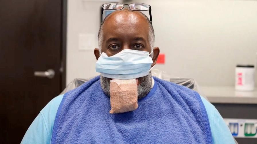 Cortan la lengua a un hombre por un extraño síntoma vinculado al coronavirus 