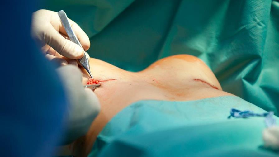Aumento de mamas con implantes, la cirugía estética más realizada en el mundo durante 2018 Aumento de mamas con implantes, la cirugía estética más realizada en el mundo durante 2018