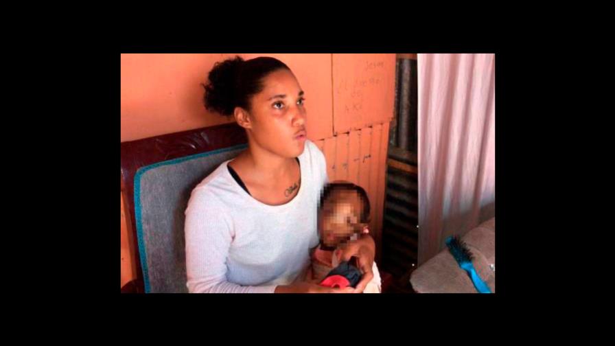 Muere niña de dos años que tenía tumor en el rostro en Hato Mayor 