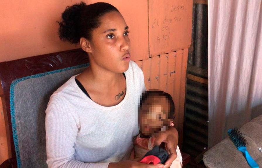 Madre pide a Abinader y a la primera dama ayuda para tratar tumor tiene su hija de 2 años en el rostro