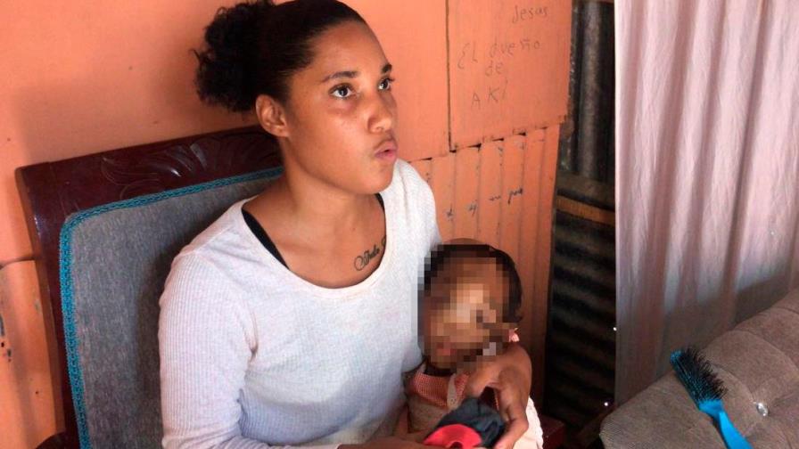 Madre pide a Abinader y a la primera dama ayuda para tratar tumor tiene su hija de 2 años en el rostro