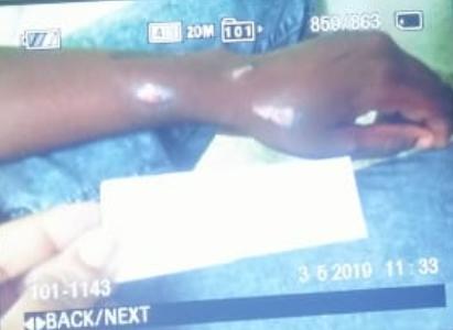 Mujer quemó con cuchara caliente a su hija de ocho años en Hato  Mayor 
