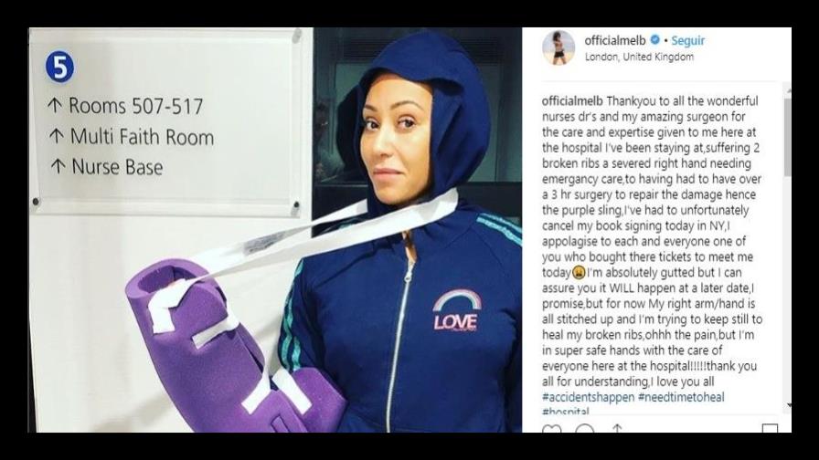 Mel B se fractura dos costillas y una de sus manos