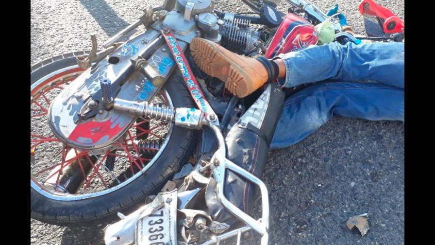 Muere motorista en accidente de tránsito en la Jacobo Majluta Muere motorista en accidente de tránsito en la Jacobo Majluta