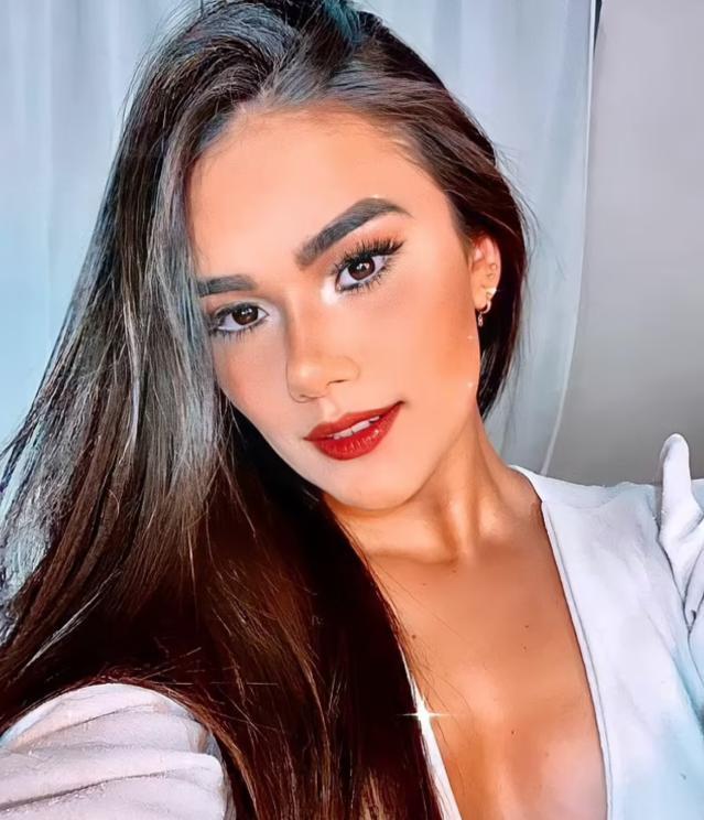 Muere reina de belleza brasileña de 21 años en medio de cirugía