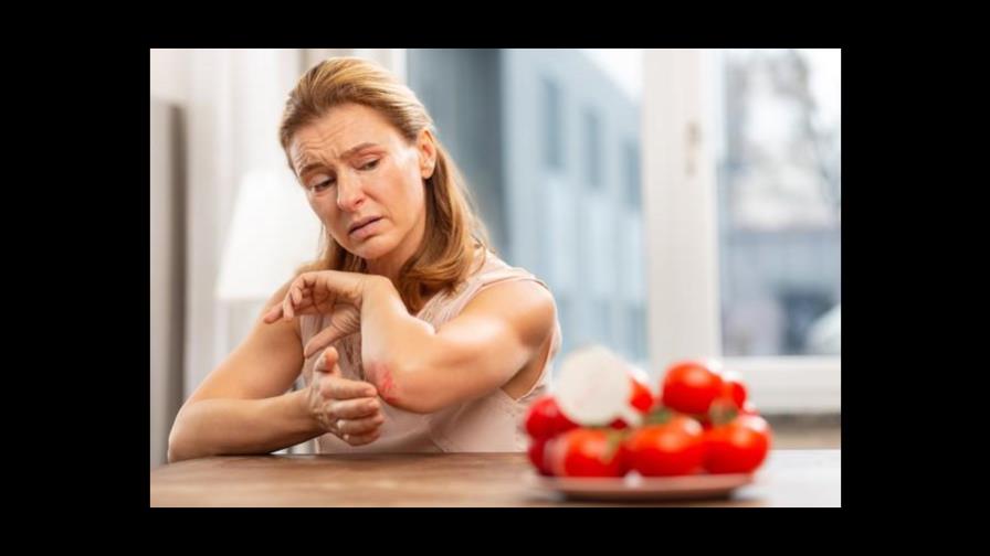 Cuidado con las alergias alimenticias y sus efectos