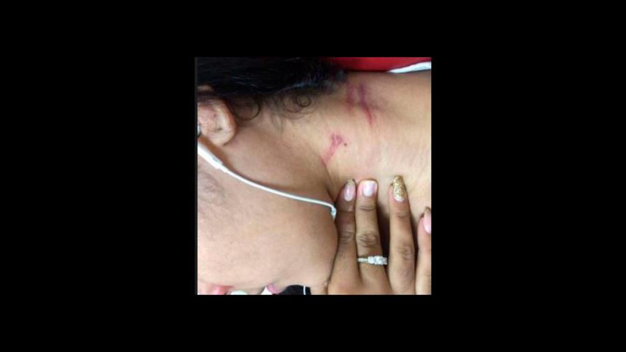 Apresan hombre en Baní acusado de golpear a su expareja