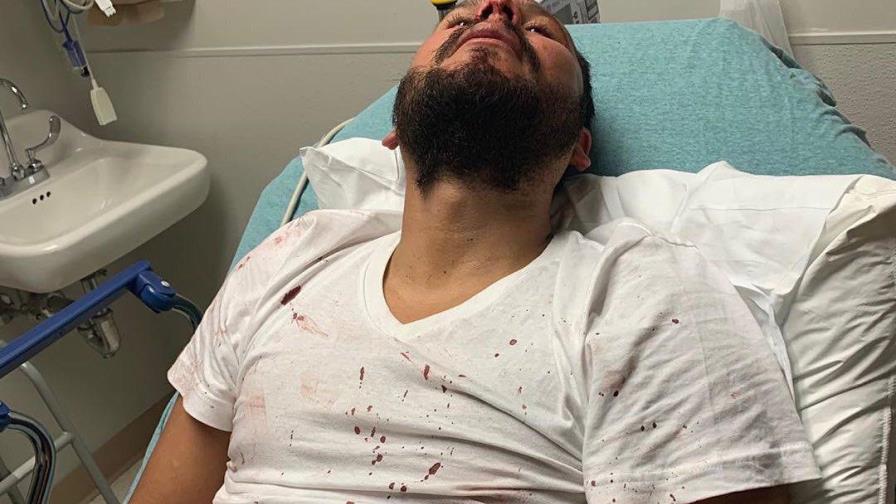 Brutal golpiza a dos músicos por hablar español en un bar de Estados Unidos 