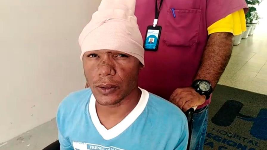 Extraen clavo que hombre se incrustó en la cabeza porque sentía su “cerebro flojo”