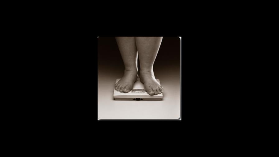 FAO: Latinoamérica está perdiendo “por paliza” la carrera contra la obesidad