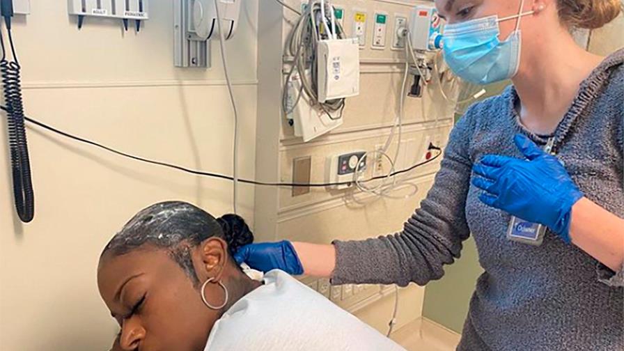 Mujer que se fijó el pelo con pegamento tendrá que operarse