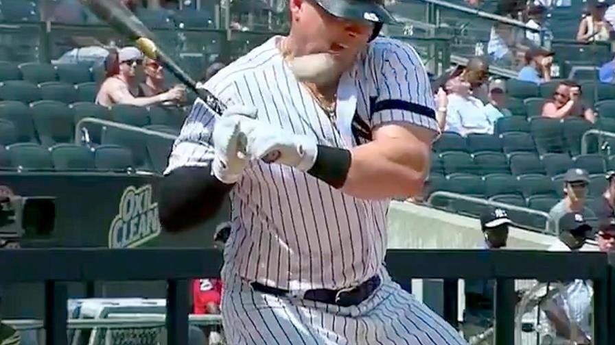 Los pelotazos dominaron la semana