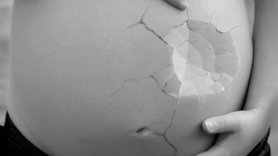 Abortan de un feto de siete meses en Colombia en contra de la voluntad del padre