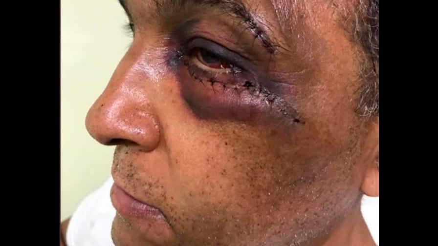 PRM suspende a Dariel Valdez tras incidente en Valverde PRM suspende a Dariel Valdez tras incidente en Valverde