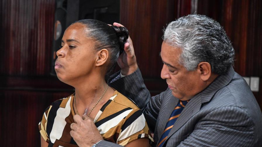 Mujer que se tragó prótesis dental está entre el 20% de los que sobreviven a esos incidentes